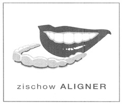 zischow ALIGNER