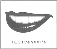 TESTveneer´s