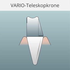 VARIO-Teleskopkrone