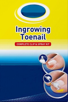 Ingrowing Toenail COMPLETE CLIP & SPRAY KIT