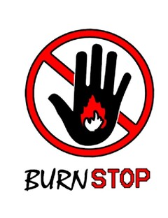 BURNSTOP