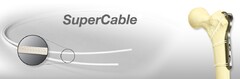 SUPERCABLE