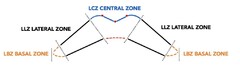 LCZ CENTRAL ZONE LLZ LATERAL ZONE LBZ BASAL ZONE LLZ LATERAL ZONE LBZ BASAL ZONE