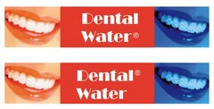 DENTAL WATER