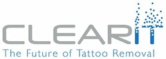 CLEARIT THE FUTURE OF TATTOO REMOVAL