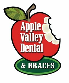 APPLE VALLEY DENTAL & BRACES