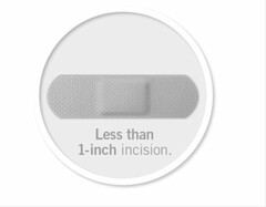 LESS THAN 1-INCH INCISION