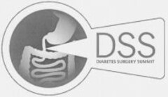 DSS DIABETES SURGERY SUMMIT