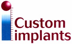 Custom implants