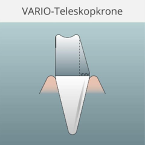 VARIO-Teleskopkrone Logo (EUIPO, 29.03.2018)